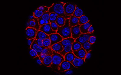Flourescent cell cluster Flourescent cell cluster