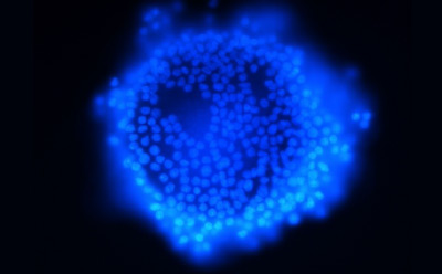 Stained cells Stained cells