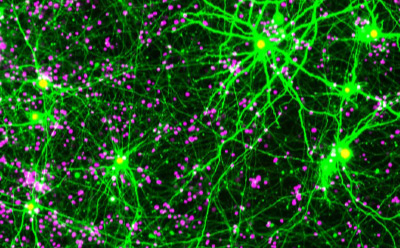 Fluorescent Cells Live cell imagery