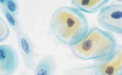 Gynecological smears 巴氏涂片样本的诊断细胞学染色