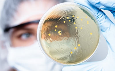 Scientist observing petri dish with bacterial colonies Scientist observing petri dish with bacterial colonies