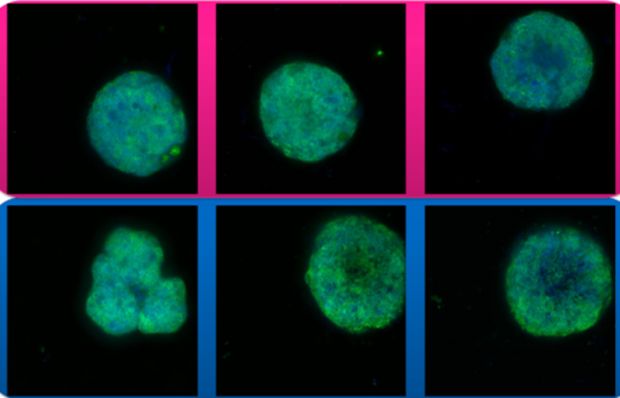 ULA Plates Vs Competition Confocal microscopy of HeLa cells using Millicell ULA and Competitor A ULA plates