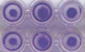 HT 1080 Cells Invasion A close-up image of a 96-well plate with each well containing HT-1080 cells with a distinct darker circular pattern in the center. The wells are arranged in two rows of three.