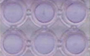 ht 1080 Cells Invasion A close-up image of a 96-well plate with each well containing HT-1080 cells. The wells are arranged in two rows of three.