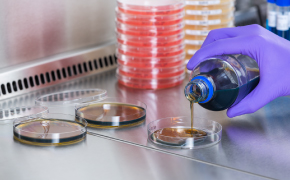 用于微生物培养基的颗粒化原材料 手戴蓝色丁腈手套的实验室工作人员打开带有Supelco®品牌标签的棕色大号溶剂瓶。图中仅显示工作人员的手和小臂。背景可见一个棕色小溶剂瓶和两个白色小瓶。