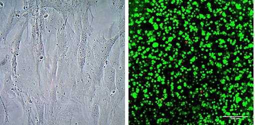 3D culture of human mesenchymal stem cells using PhotoHA 3D culture of human mesenchymal stem cells using PhotoHA®