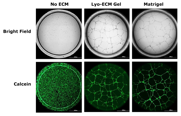 Angiogenesis assays The image is segmented into six images. The top images are visualized using brightfield microscopy. The top right image is a insert with no ECM, and looks clear. The top middle image is cells seeded in Lyo-ECM gel, and shows a cellular monolayer. The top right image is cells seeded in Matrigel and also shows a cellular monolayer. The bottom three images are visualized using fluorescent microscopy. The top right image is a insert with no ECM, and shows background fluorescence. The top middle image is cells seeded in Lyo-ECM gel, and shows a cellular monolayer through Calcein staining. The top right image is cells seeded in Matrigel and also shows a cellular monolayer through Calcein staining.