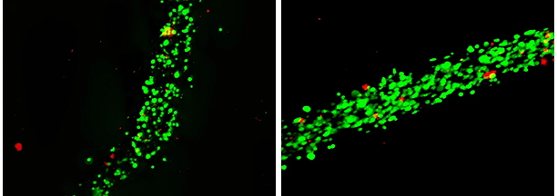 Bioprinting of human mesenchymal stem cells using PhotoCol Bioprinting of human mesenchymal stem cells using PhotoCol