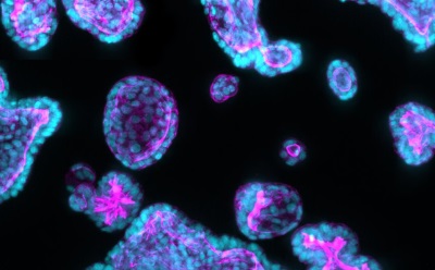 Microscopy of patient-derived organoids
