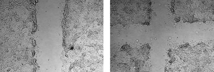 Using the CellComb scratch assay, monolayers of NIH3T3 cells were scratched/wounded in a one-direction (left) or two-direction (right) pattern. Using the CellComb scratch assay, monolayers of NIH3T3 cells were scratched/wounded in a one-direction (left) or two-direction (right) pattern.