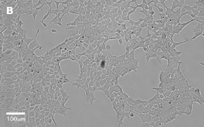 millicell-cell-lines-12022001-b Brightfield imaging of HEK 293T cells on Millicell<sup>®</sup> DCI Digital Cell Imager at 20X magnification