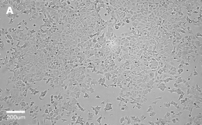 millicell-cell-lines-86012803-a Brightfield imaging of MCF-7 cells on Millicell<sup>®</sup> DCI Digital Cell Imager at 10X magnification