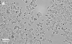 millicell-cell-lines-86012803-b Brightfield imaging of MCF-7 cells on Millicell<sup>®</sup> DCI Digital Cell Imager at 20X magnification