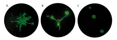 3d-culture-matrix-laminin Mammary epithelial cells