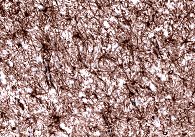 Neural Stem Cell Markers and Antibodies Immunohistochemical staining of the human cerebral cortex shows strong cytoplasmic positivity in astrocytes.