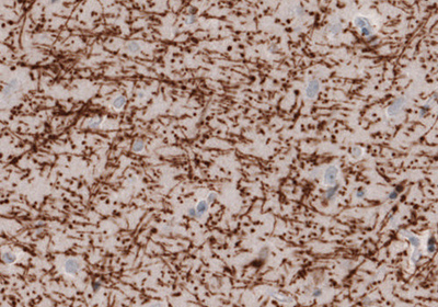 Neural Stem Cell Markers and Antibodies Immunohistochemical staining of the human cerebral cortex .