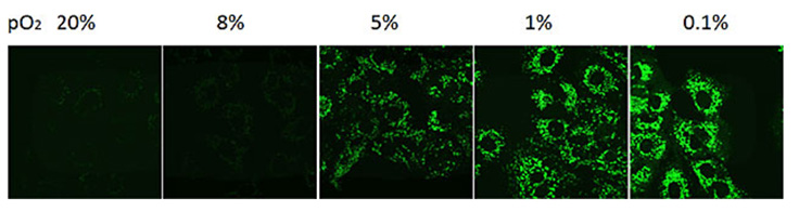 measurement-of-hypoxia-in-cancer-cells Measurement of hypoxia in cancer cells.