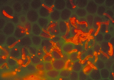 Plasmodium Stained Plasmodium Stained
