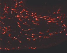 Young Migrating Neurons Labeled Young Migrating Neurons Labeled