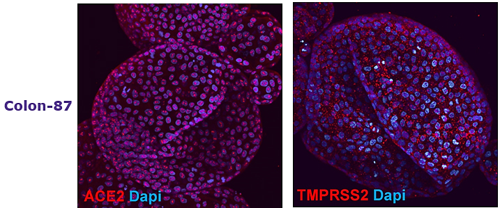 Adult tissue derived colon (SCC321, Colon-87) Adult tissue derived colon (SCC321, Colon-87) and duodenum (SCC320, DUO-85) organoids express SARS-CoV-2 related proteins ACE2 and TMPRSS2.