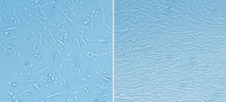 ECM matrix coating enables rapid expansion of fetal lung fibroblasts ECM matrix coating enables rapid expansion of fetal lung fibroblasts