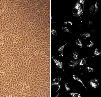 Bovine Aortic Endothelial Cells (BAOEC) Bovine Aortic Endothelial Cells (BAOEC)