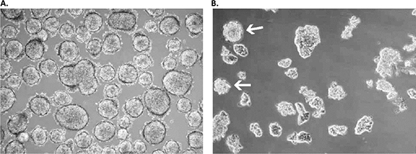 primary-culture Primary culture derived from a low-grade small cell lung cancer with the Primary Cancer Culture System.