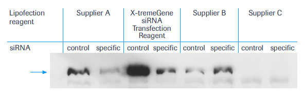 Typical example of an immunoblot Typical example of an immunoblot