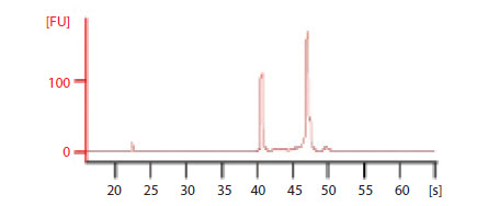 Electropherogram of total RNA Electropherogram of total RNA