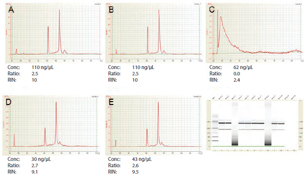 Agilent 2100 BioAnalyzer Analysis of RNA Samples A–E Agilent 2100 BioAnalyzer Analysis of RNA Samples A–E