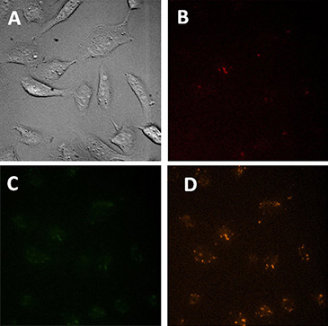 Microscopic images of control cells Microscopic images of control cells (treated only with transfection reagent).