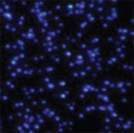 dark-field-microscopy 暗场显微图像