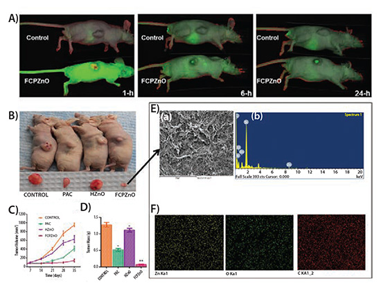 Regression of MDA-MB-231 tumor xenografts in mice treated with FCPZnO and PAC Regression of MDA-MB-231 tumor xenografts in mice treated with FCPZnO and PAC