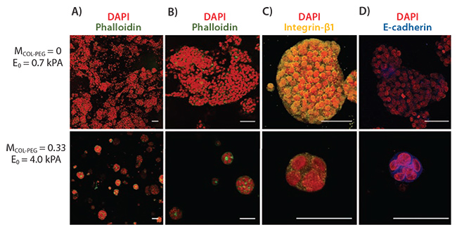 Effects of hydrogel elastic modulus Effects of hydrogel elastic modulus