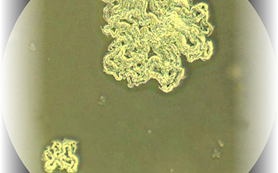 10x Magnification Mycobacterium Tuberculosis 10倍显微镜下的结核分枝杆菌