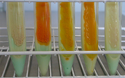 Different Mycobacteria Species Grown On TB-Medium TB培养基上生长的不同分枝杆菌菌种