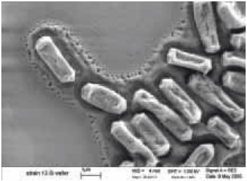 Scanning electron micrograph of C. perfringens grown on a silicon wafer (source: S. Melville, Department of Biological Sciences, Virginia Tech University) 在硅片上生长的产气荚膜梭菌的扫描电子显微照片(来源:S. Melville,弗吉尼亚理工大学生物科学系)