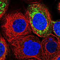 Anti-MRPS7 antibody stained in green showing single cell variation in A-431 cell line. Anti-MRPS7 antibody stained in green showing single cell variation in A-431 cell line.