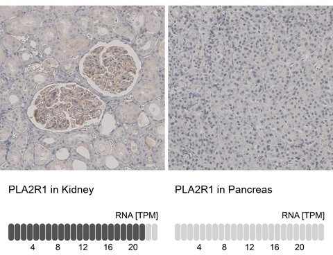 hpa012657-ihc-n hpa012657-ihc-n
