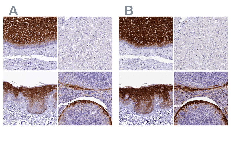 Immunohistochemical staining 人食道、肝、皮肤和扁桃体组织的免疫组化染色,A2ML1独立抗体HPA038847(A)与HPA038848(B)在组织中呈现相似的蛋白分布模式。