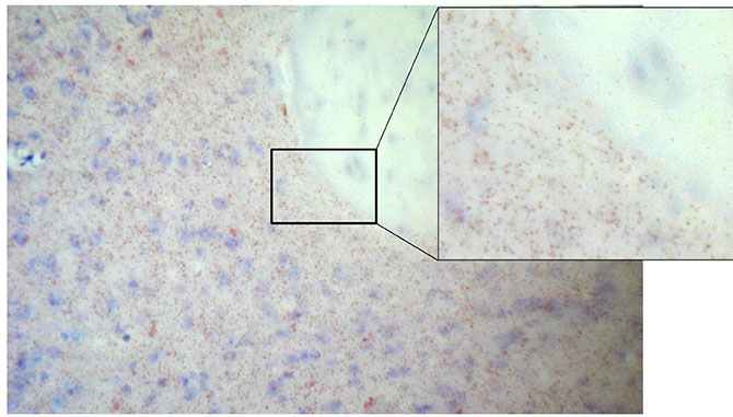 Count Duolink signals in counterstained area using Duolink Image Tool duolink brightfield detection