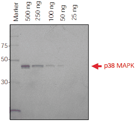Direct Detection of Histidine-Tagged Proteins on SDS-PAGE Gels Direct Detection of Histidine-Tagged Proteins on SDS-PAGE Gels