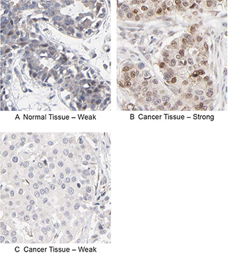 RBM3 Antibody RBM3 Antibody