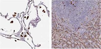 CD68/Macrosialin CD68/Macrosialin