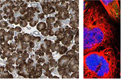 ihc-staining-of-human-pancreas-tissue ihc-staining-of-human-pancreas-tissue