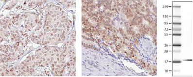 RBM3 Antibodies RBM3 Antibodies
