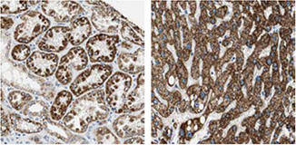 p5c-dehydrogenase-aldh4a1 p5c-dehydrogenase-aldh4a1