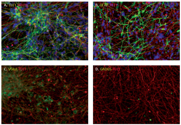 Neuronal differentiation of iPSC derived NPCs. Neuronal differentiation of iPSC derived NPCs.