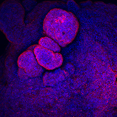 CA-IV CA-IV/DAPI