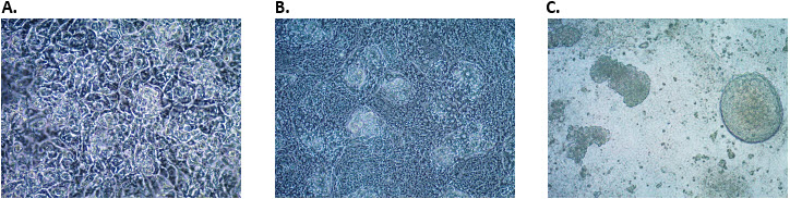 Differentiation of definitive endoderm cells into hindgut endoderm cells. Differentiation of definitive endoderm cells into hindgut endoderm cells. Morphology of hindgut endoderm cells at A) day 2 B) day 3 and C) day 4 post hindgut endoderm induction.